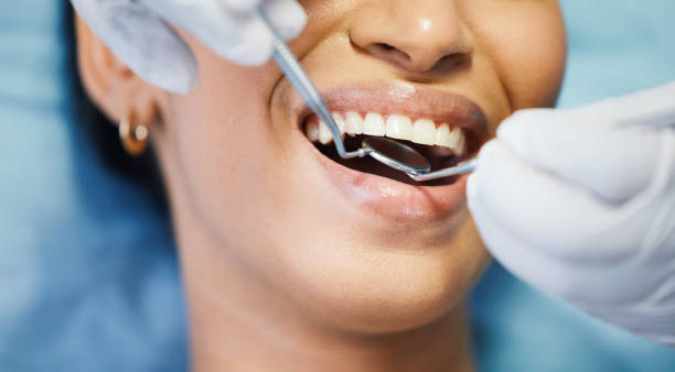 Best Emergency Broken Tooth Repair in Exander City, AL