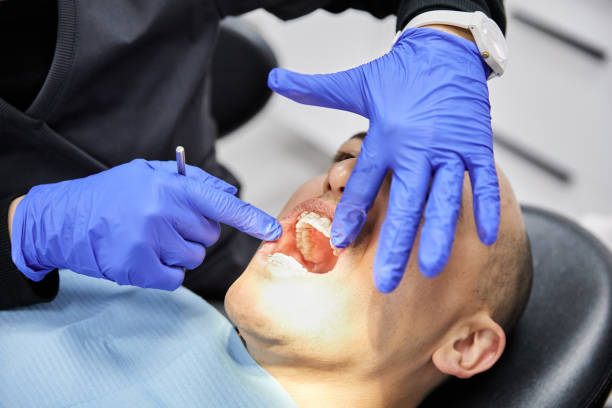 Best Emergency Dental Surgery in Exander City, AL