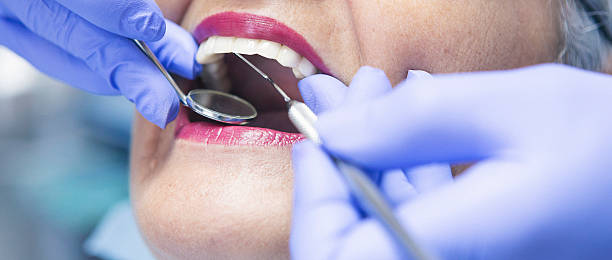 Best Emergency Treatment for Toothache in Exander City, AL